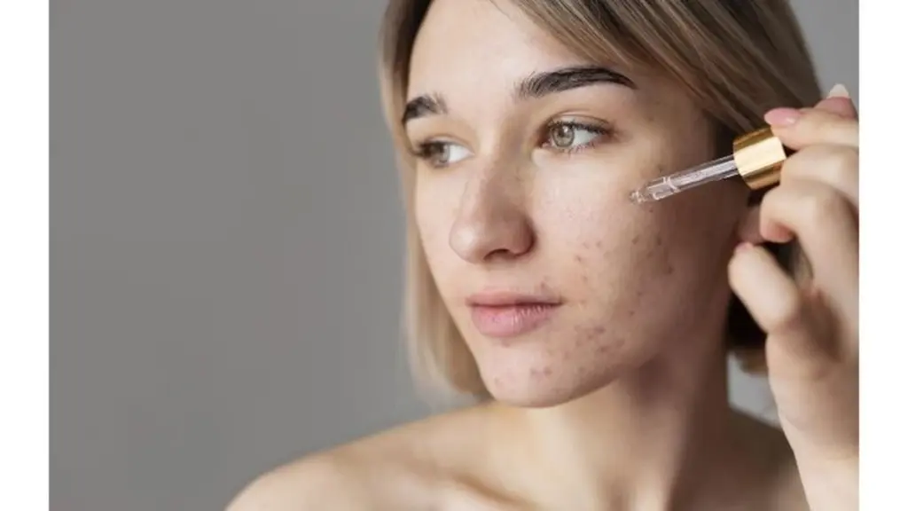 Slip af med akne: 8 fejl min dermatolog siger, jeg skal stoppe med